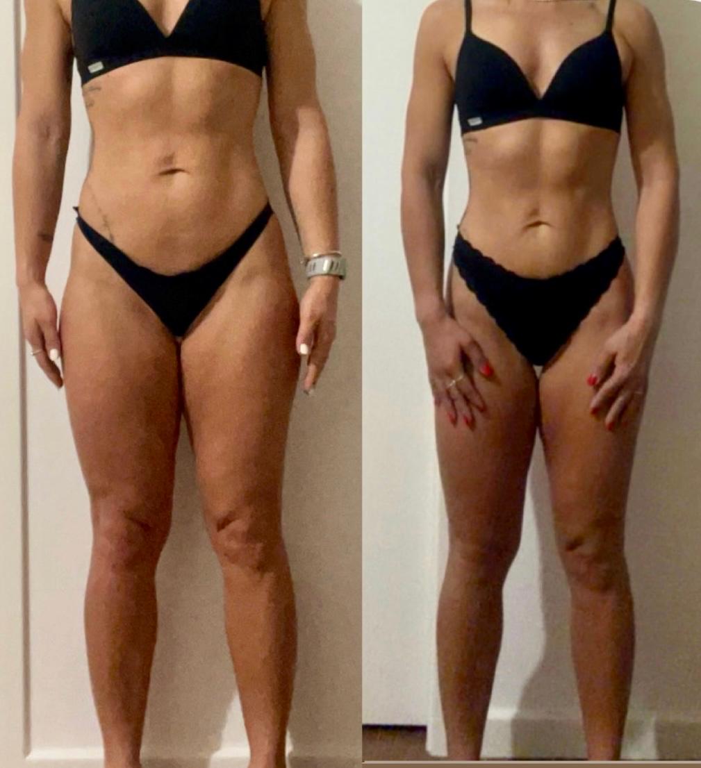 Antes e depois — 40 anos
