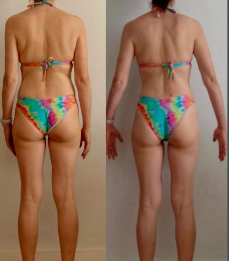 Antes e depois — 46 anos (costas)