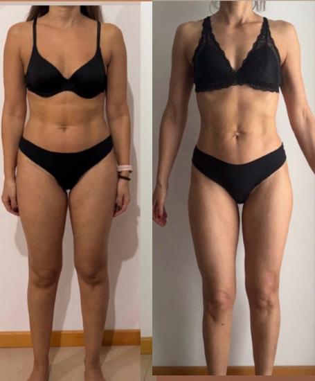 Antes e depois — 47 anos (frente)