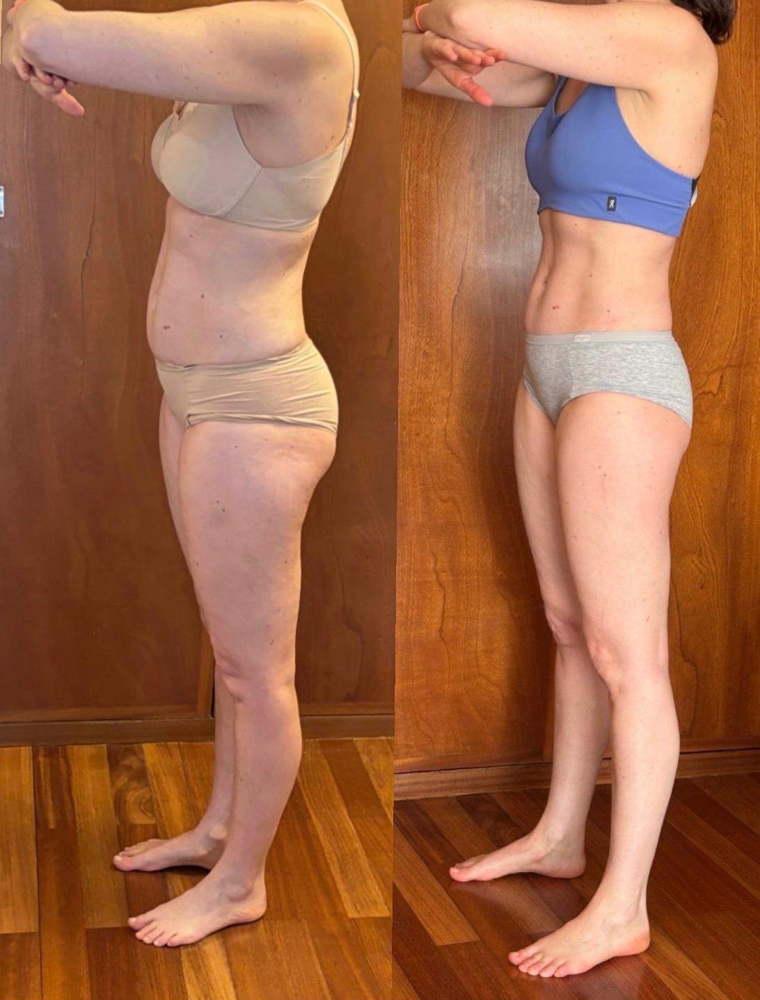 Antes e depois — 48 anos