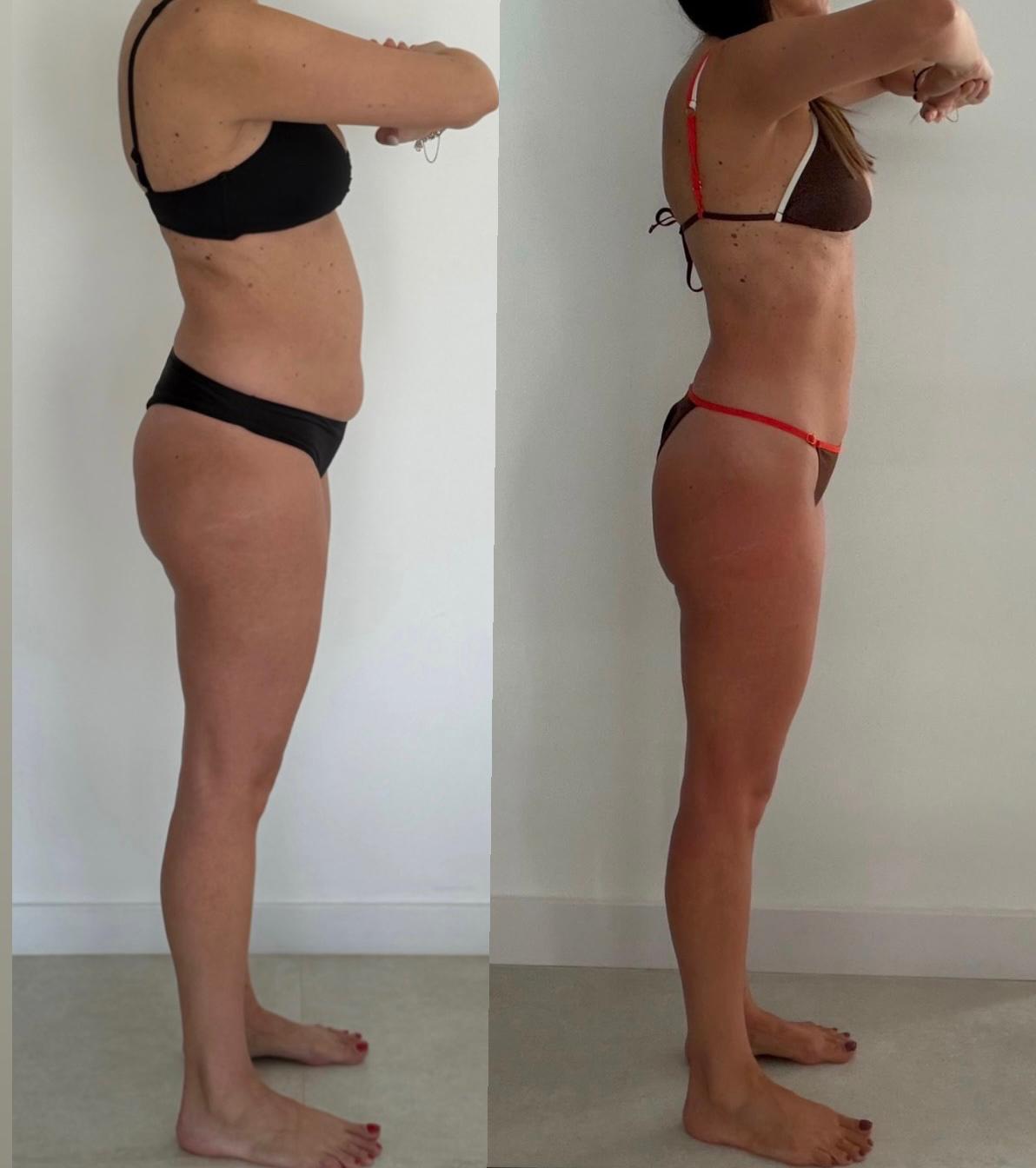 Antes e depois — 49 anos